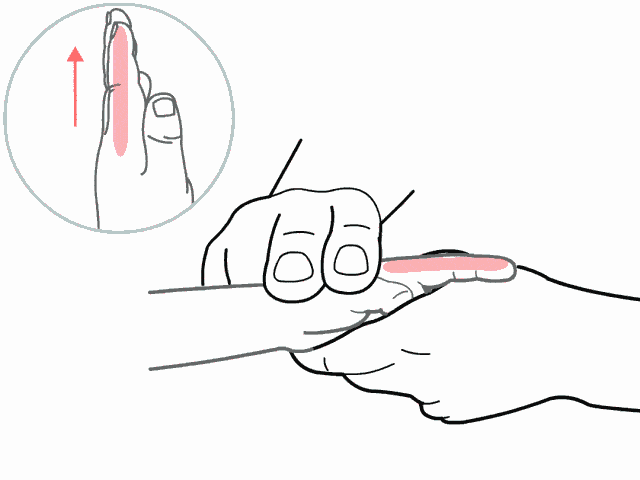 大肠经是在宝宝食指桡侧缘,从指尖到指根成一条直线,由指根向指尖方向